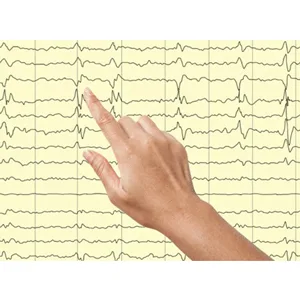 Udemy – Learn Essentials of Adult Electroencephalography (EEG) 2023-8